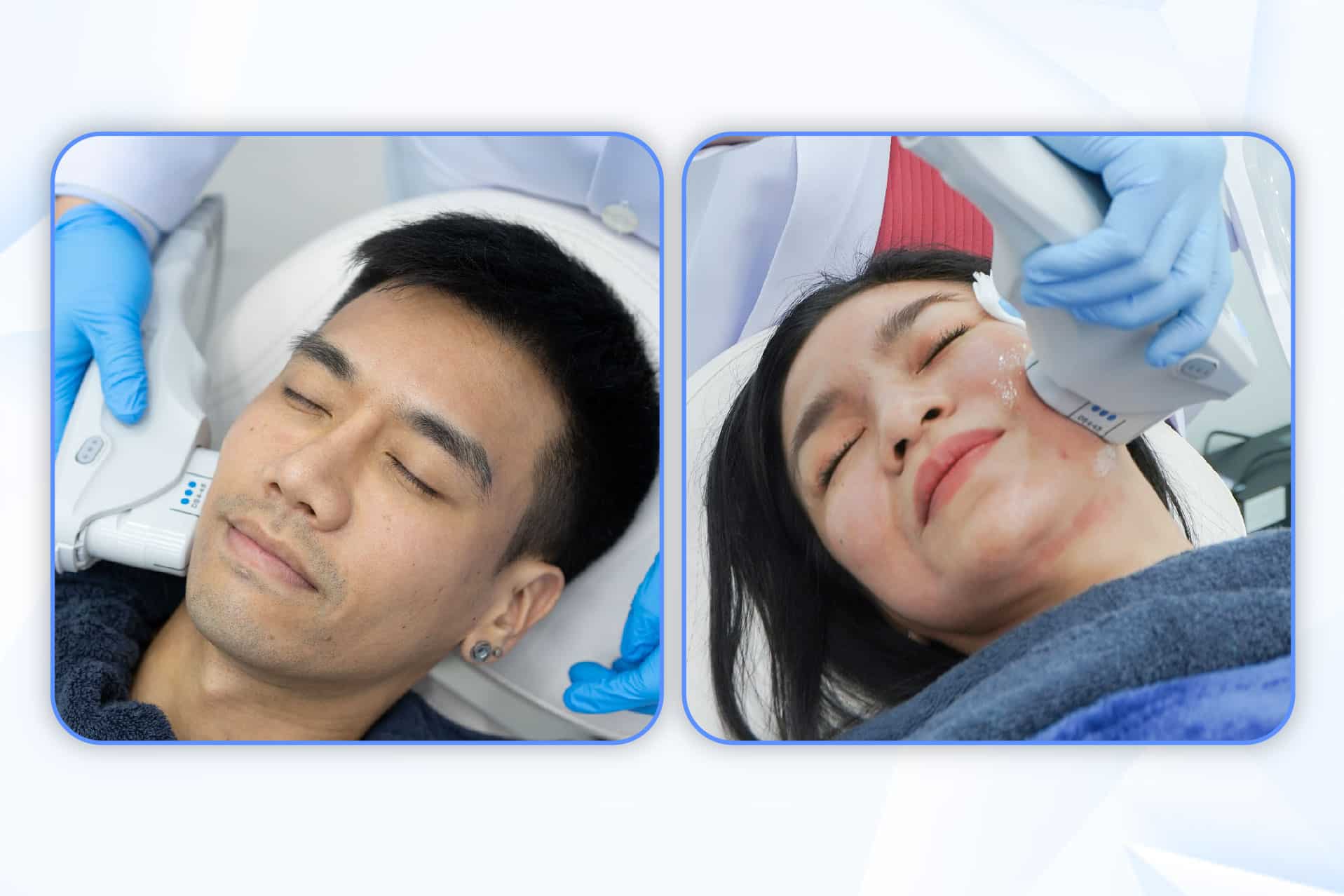 ความรู้สึกขณะทำ Ulthera เจ็บน้อยกว่า เห็นผลลัพธ์ดีกว่า