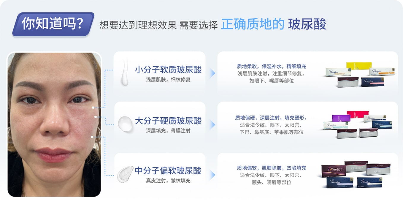 เติมฟิลเลอร์ให้ได้ผล_DT