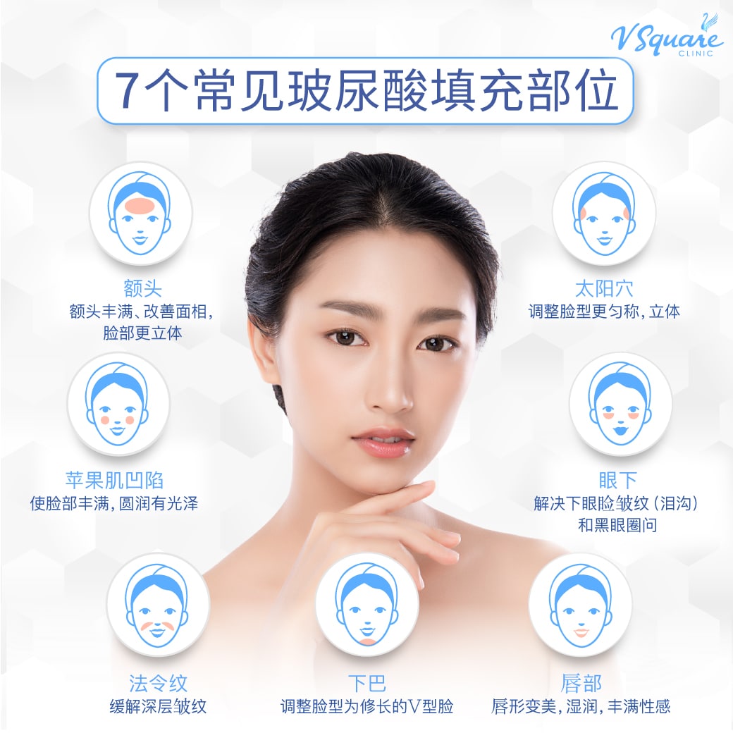 Dermal Filler injection