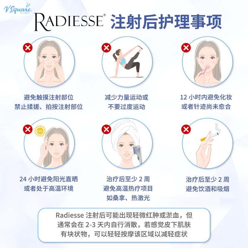 Radiesse Filler Aftercare
