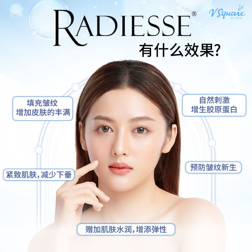 Radiesse Filler benefit