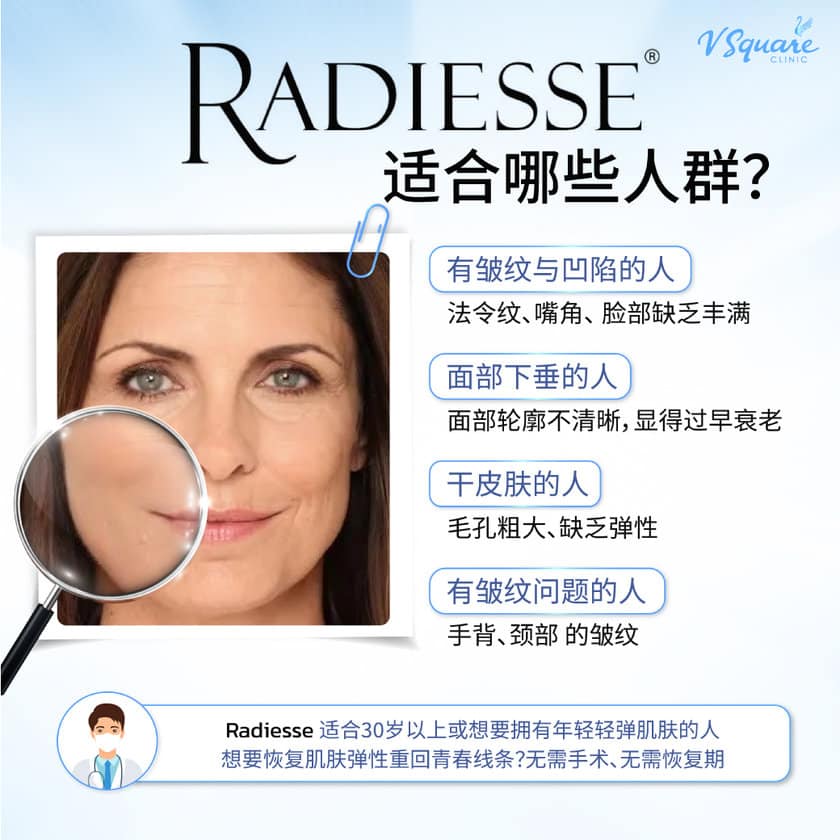 Radiesse Filler best candidate