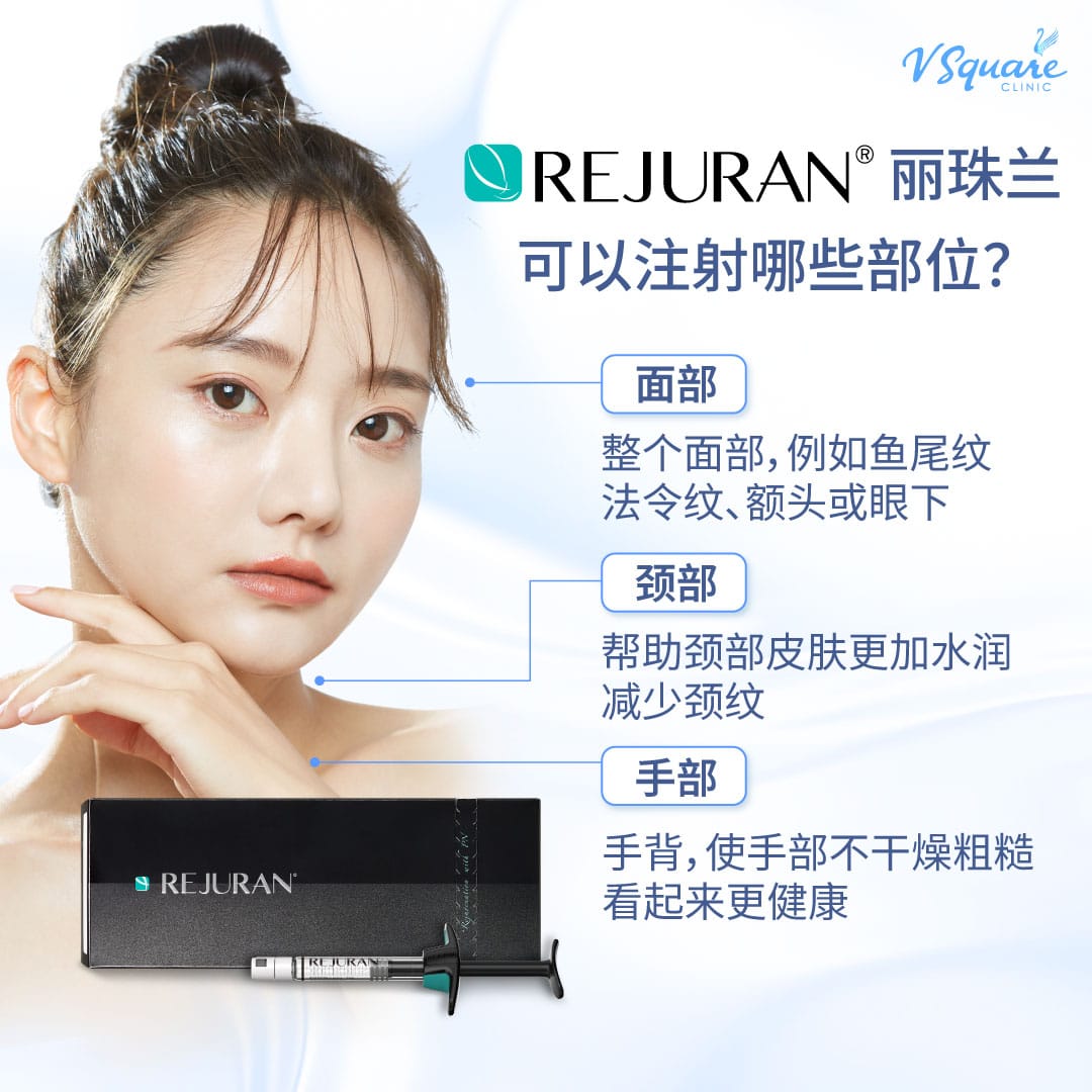 Rejuran injection area