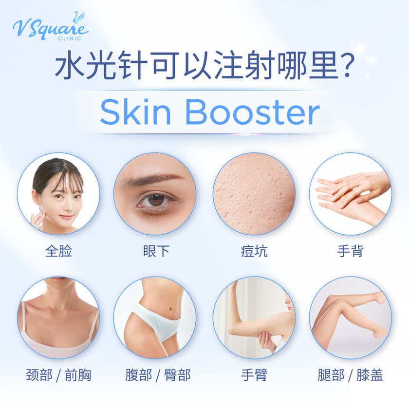 Skin Booster Injection Area
