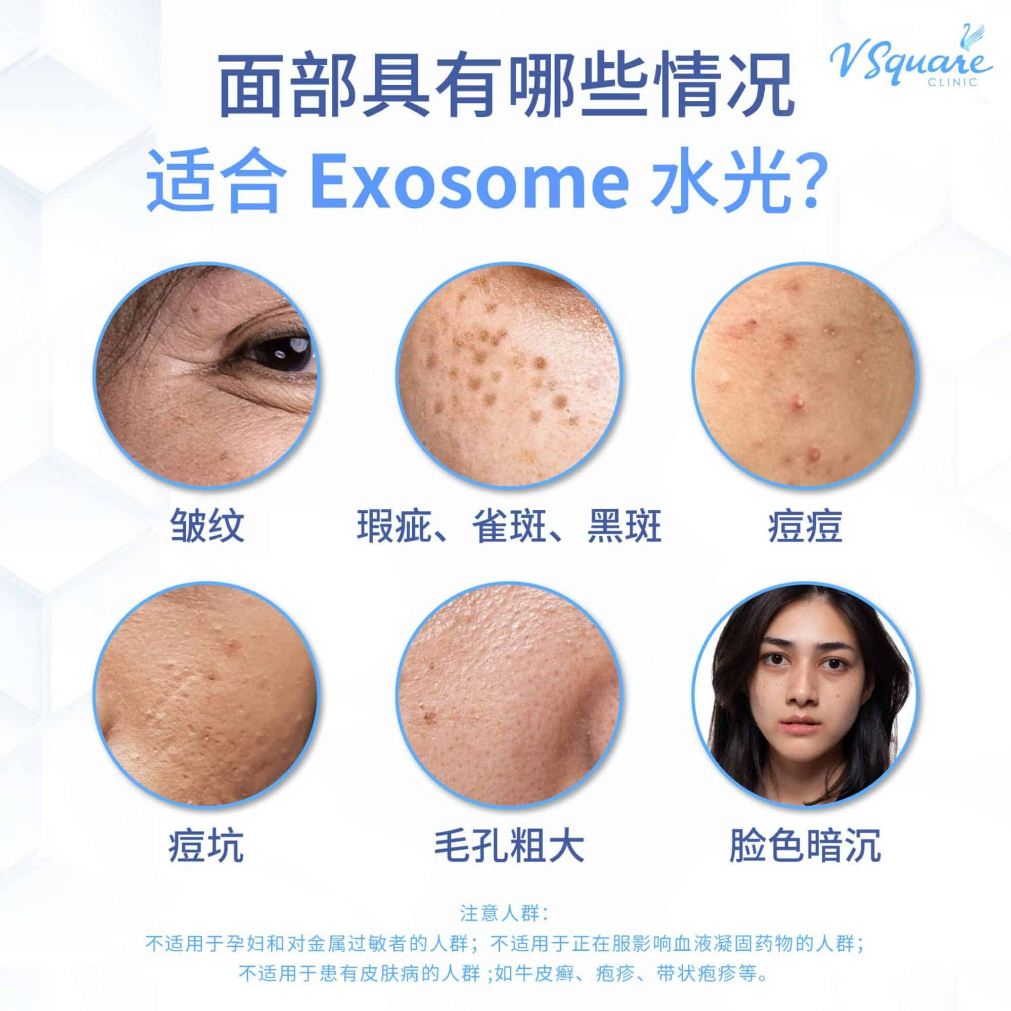 best candidate for Exosome injection