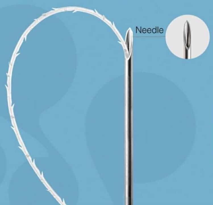 facelifting needle(1)