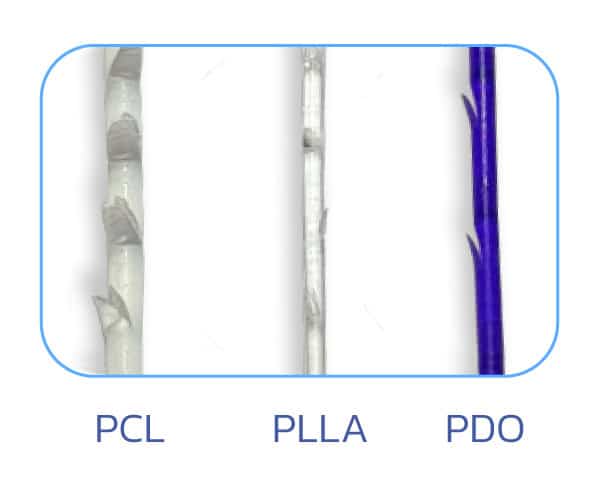 types of thread lifts