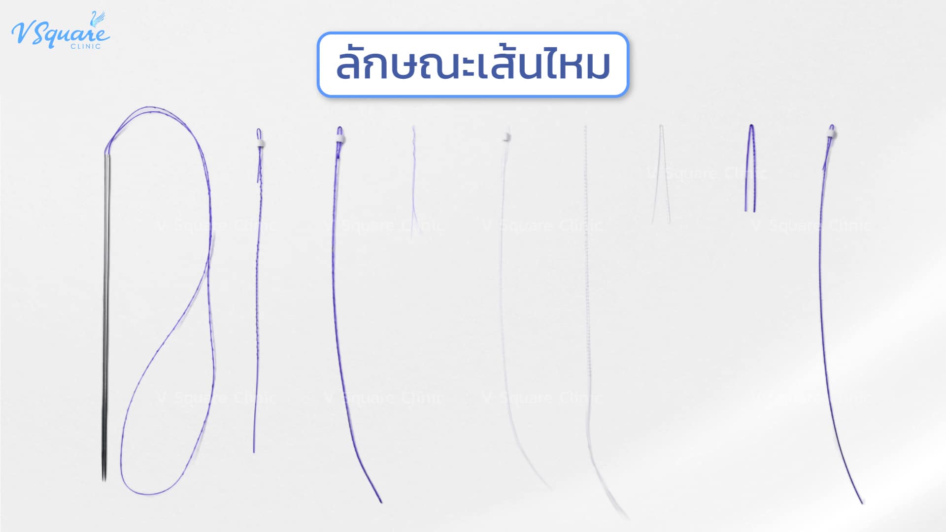 types of thread lifts(1)