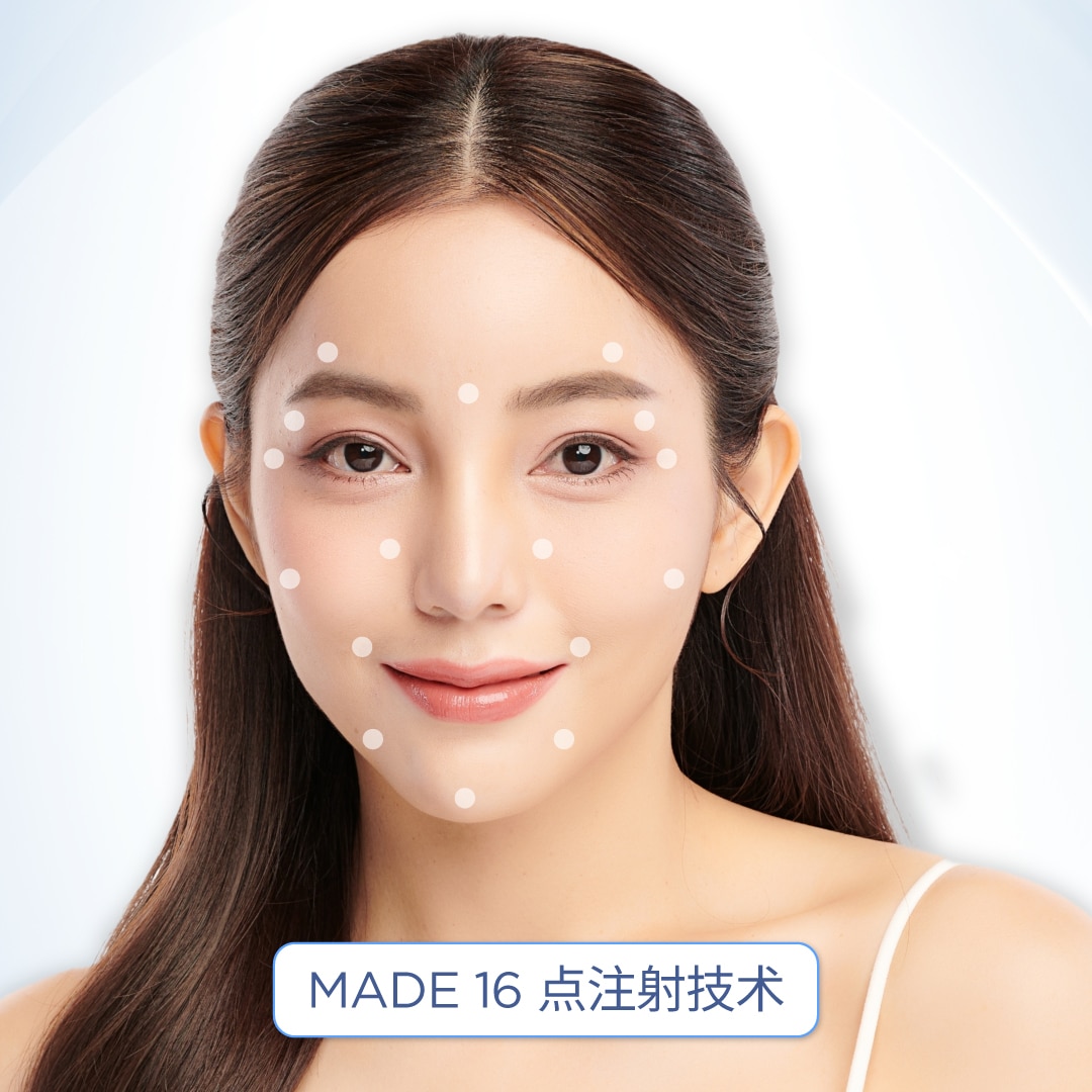 16-point mesotherapy injection technique