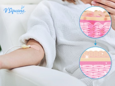 Intravenous Vitamin Therapy 维他命点 370x277