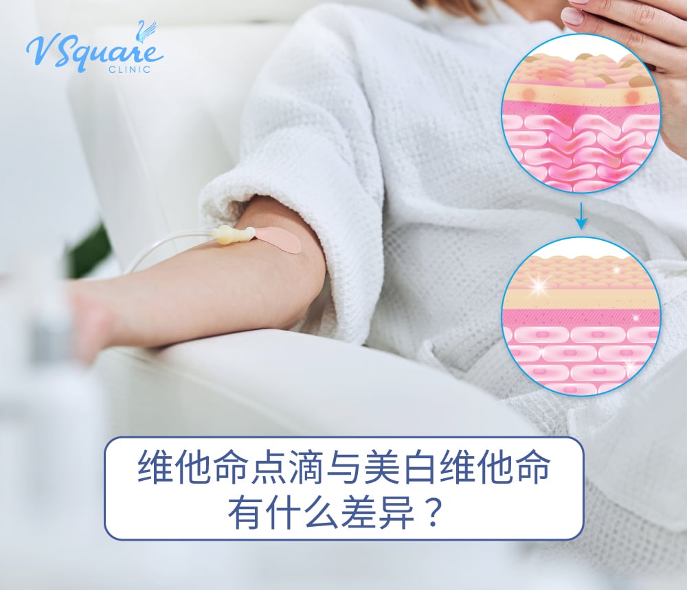 Intravenous Vitamin Therapy 维他命点