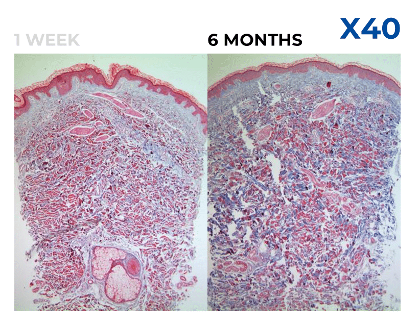 Juvelook how it works