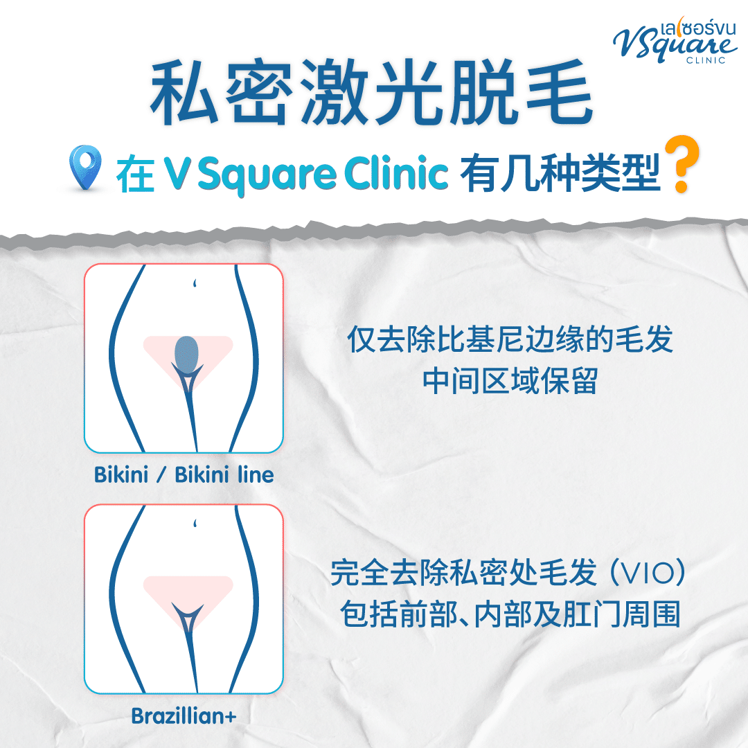 Laser female intimate hair