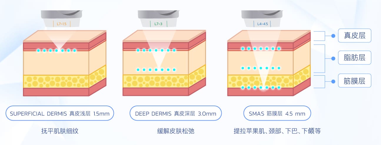 Ultraformer III Handpieces