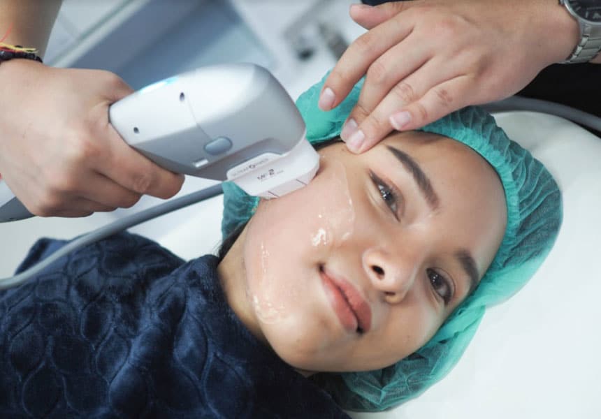 Ultraformer III procedure