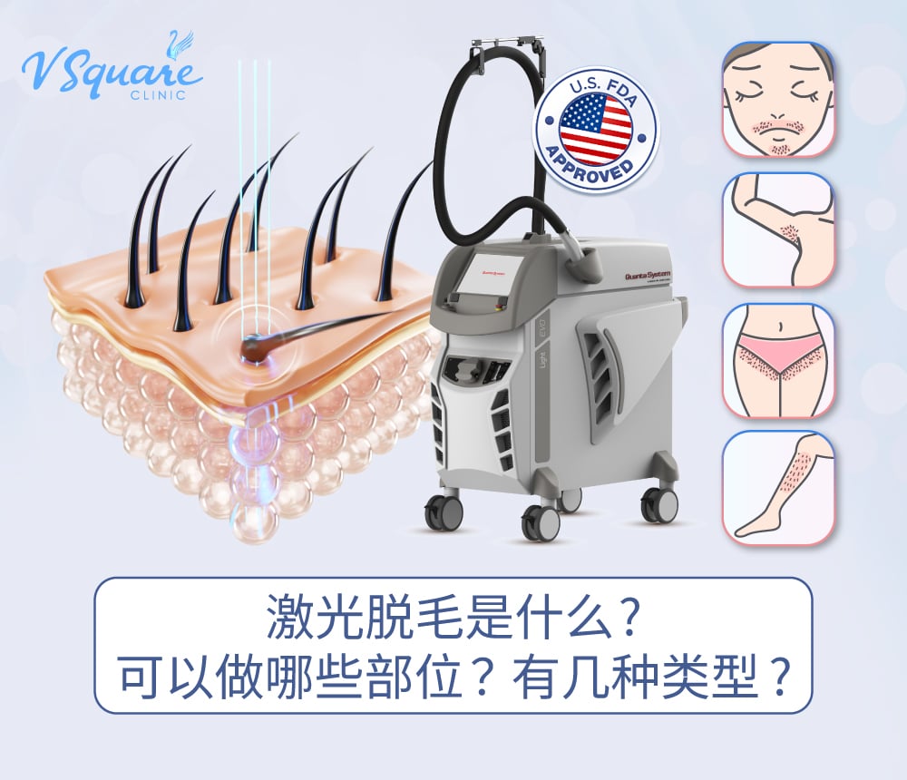 永久激光脱毛 Laser Hair Removal
