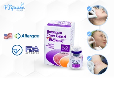 Botox Allergan 美国肉毒素-370x277