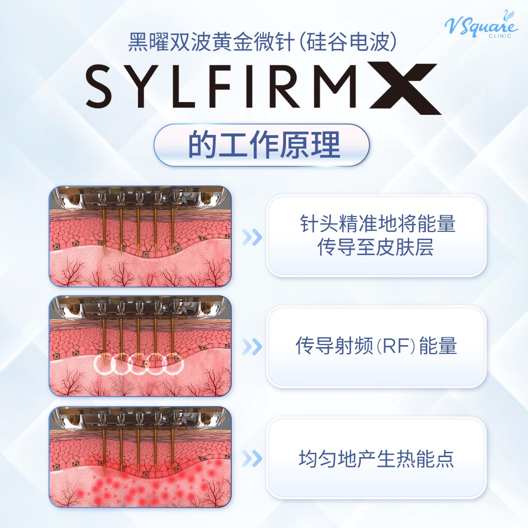 SYLFIRM 的共工作原理 how works