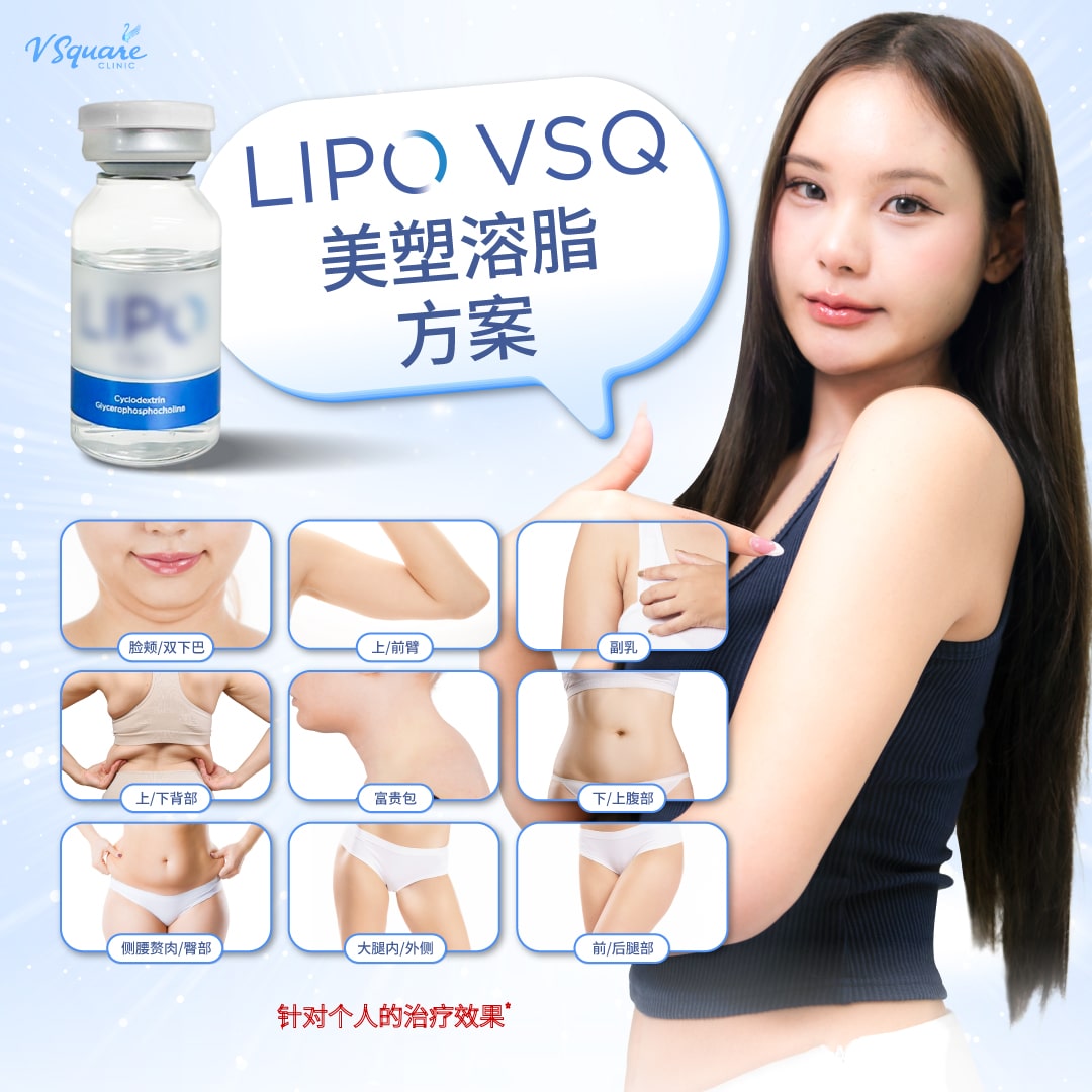 mesofat injection areas