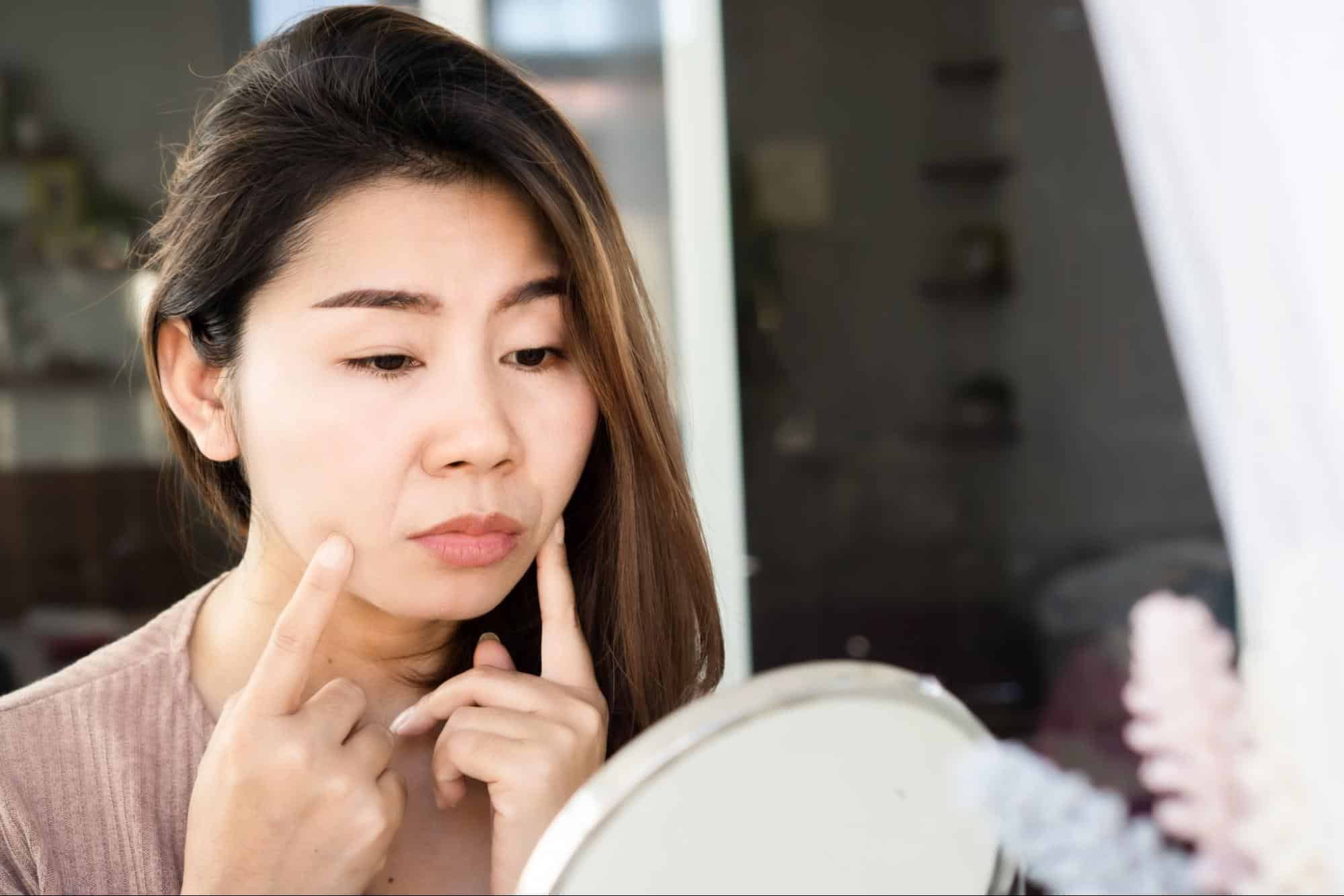 Collagen Biostimulator candidate