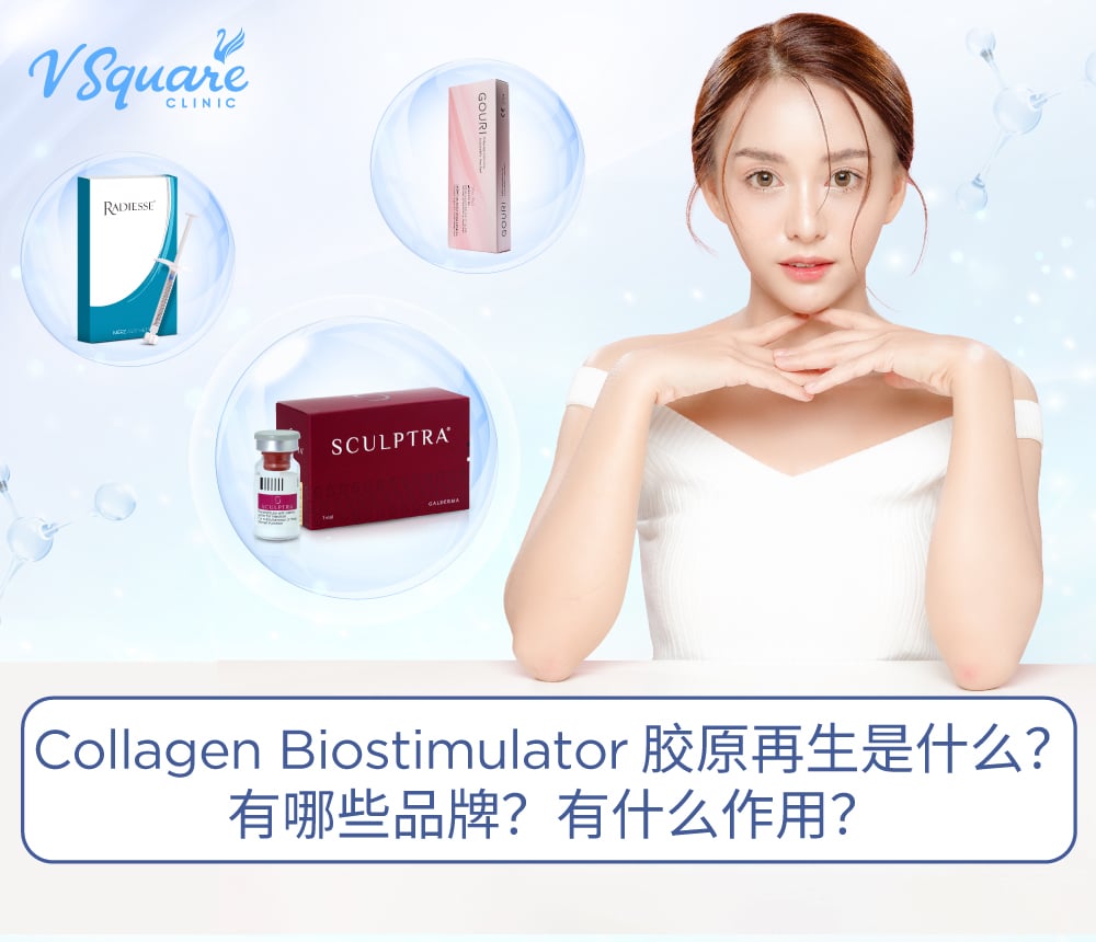Collagen Biostimulator 胶原蛋白生物刺激剂