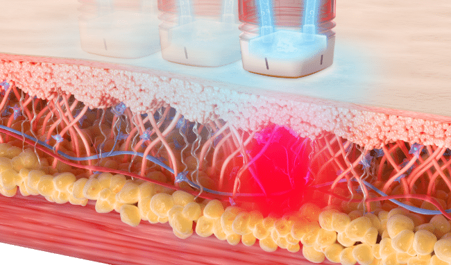 Hydro Cooling System