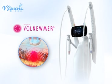 Volnewmer 黄金椿-370x277