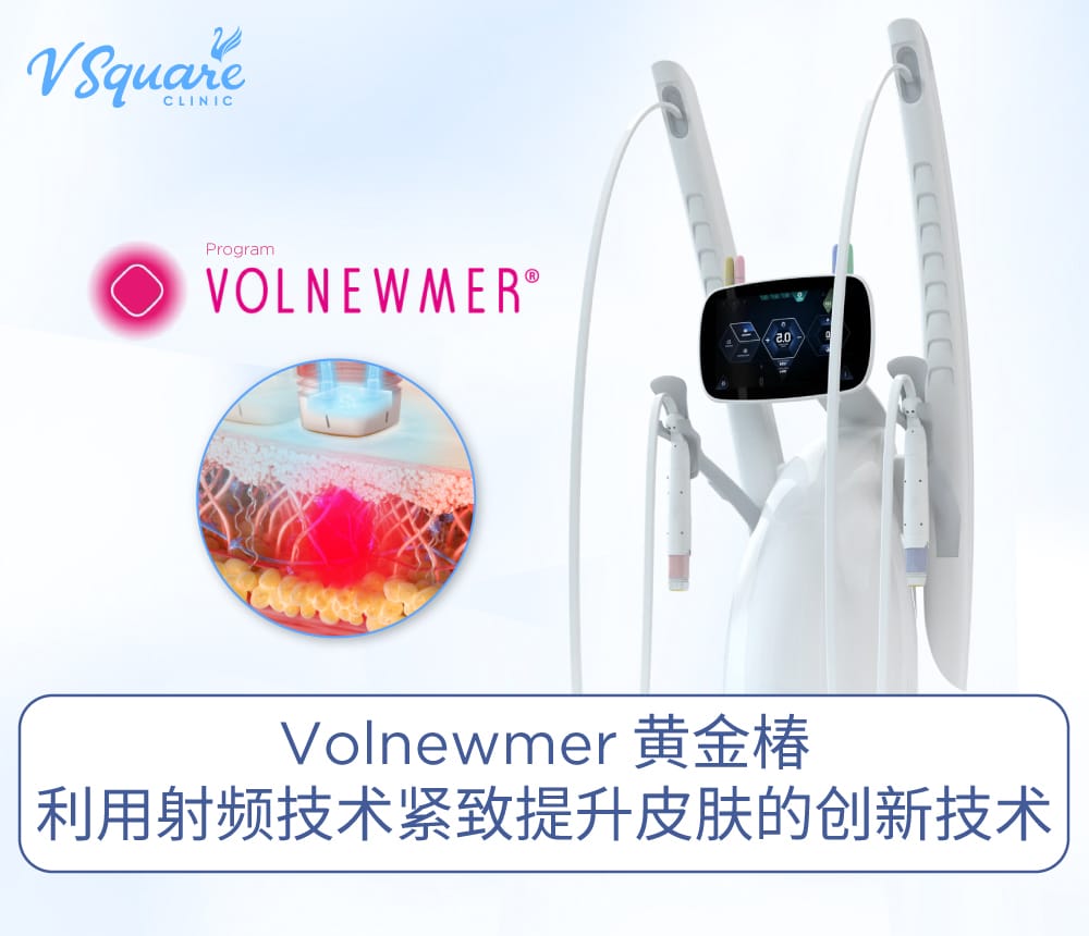Volnewmer 黄金椿
