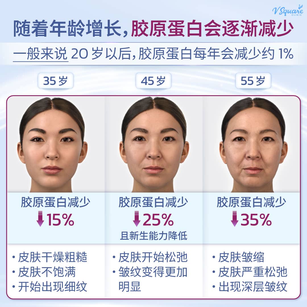 collagen decrease with ages