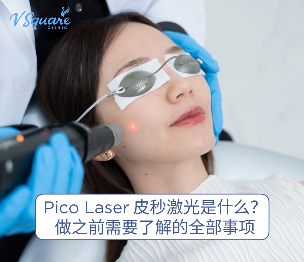 pico laser 皮秒激光
