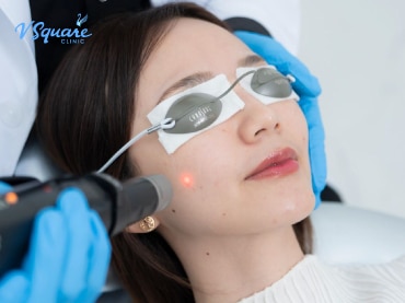 pico laser 皮秒激光