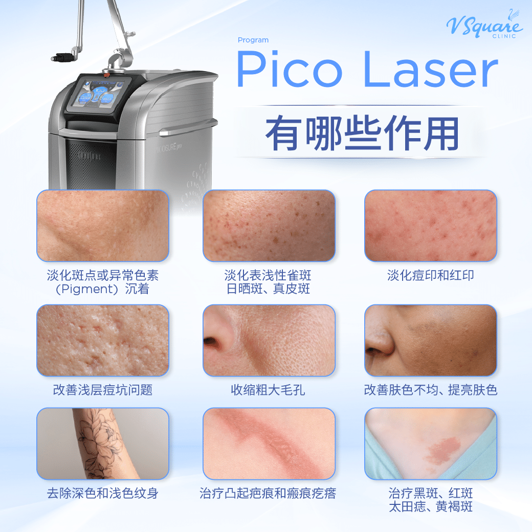 what does pico laser treat